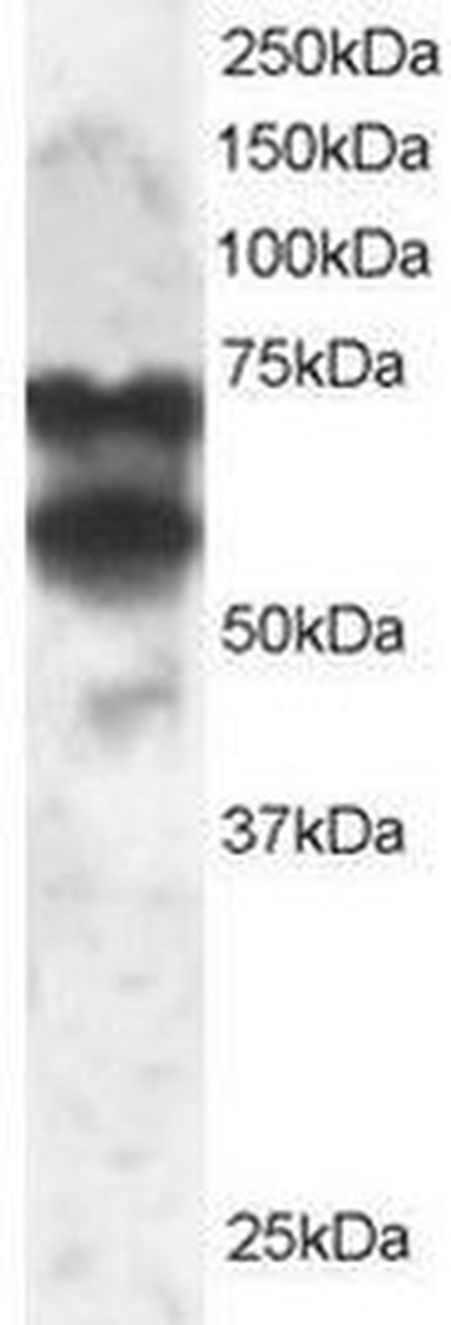 PPP2R5D Antibody in Western Blot (WB)