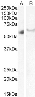 IRF6 Antibody in Western Blot (WB)