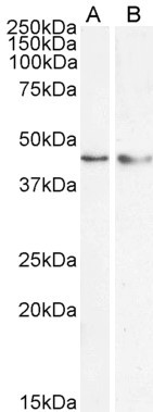 KLF15 Antibody in Western Blot (WB)