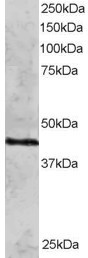 RAD51C Antibody in Western Blot (WB)
