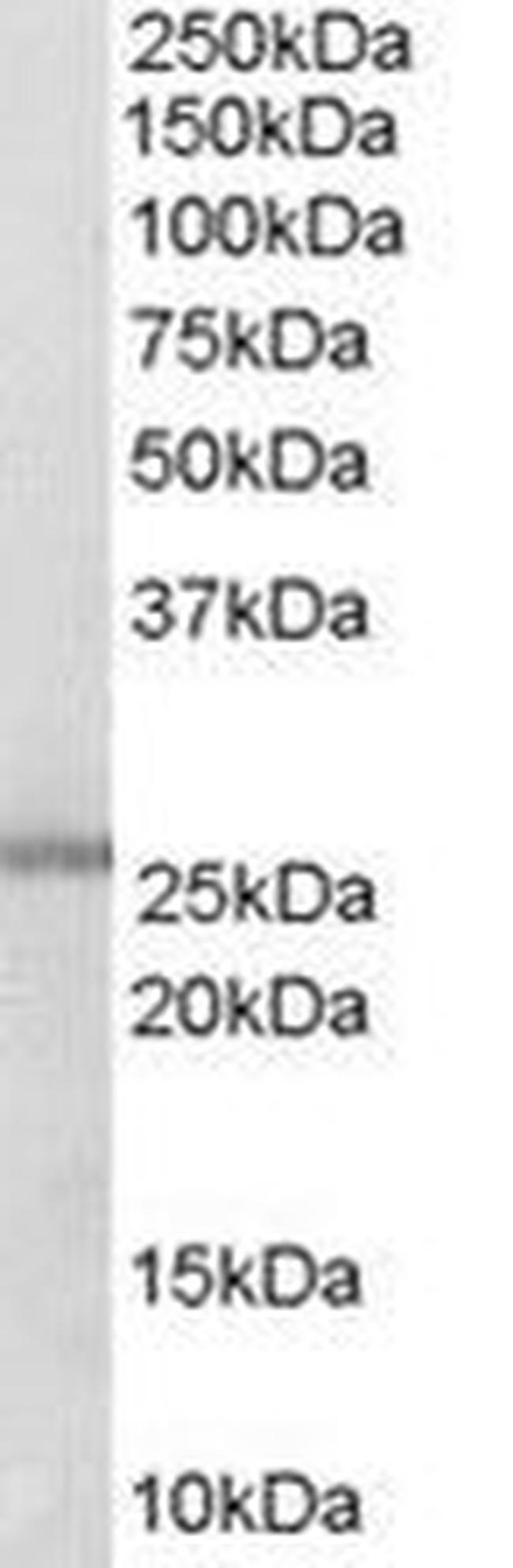 GSTM1/GSTM2 Antibody in Western Blot (WB)