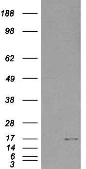 SH2D1A Antibody in Western Blot (WB)