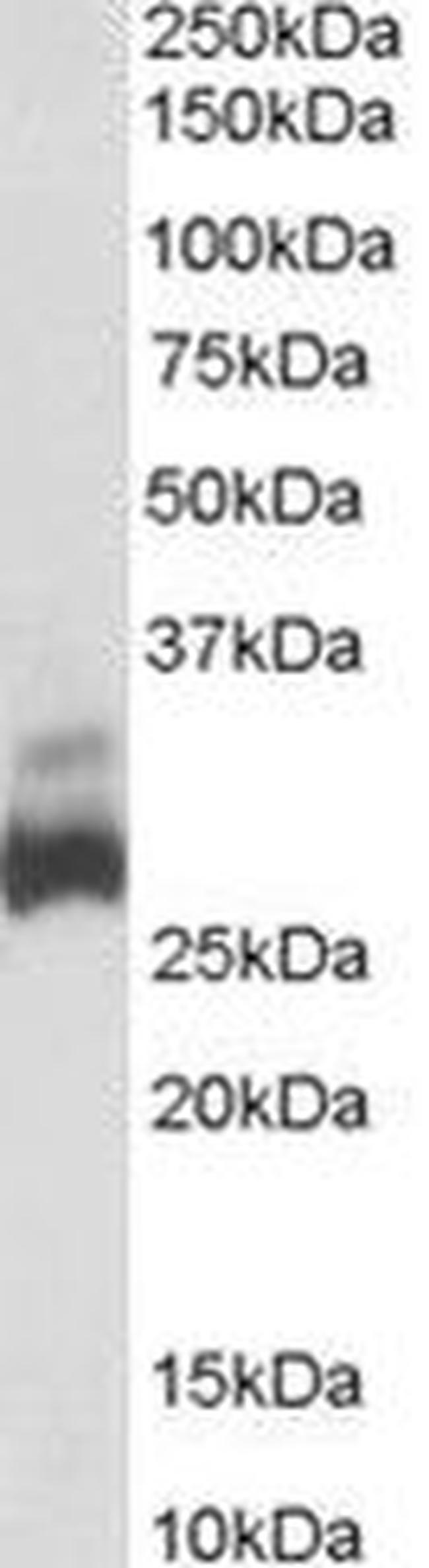 SDHB Antibody in Western Blot (WB)