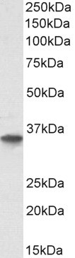 GDF15 Antibody in Western Blot (WB)
