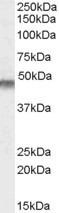 Kir6.2 (KCNJ11) Antibody in Western Blot (WB)