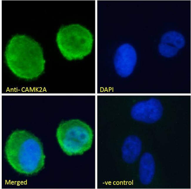 CaMKII alpha Antibody in Immunocytochemistry (ICC/IF)