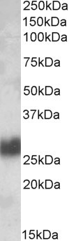 CD90 Antibody in Western Blot (WB)