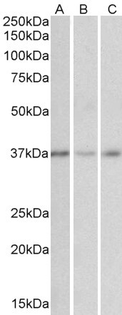 MICS1 Antibody in Western Blot (WB)