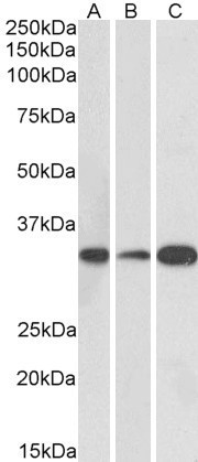 MAPRE3 Antibody in Western Blot (WB)