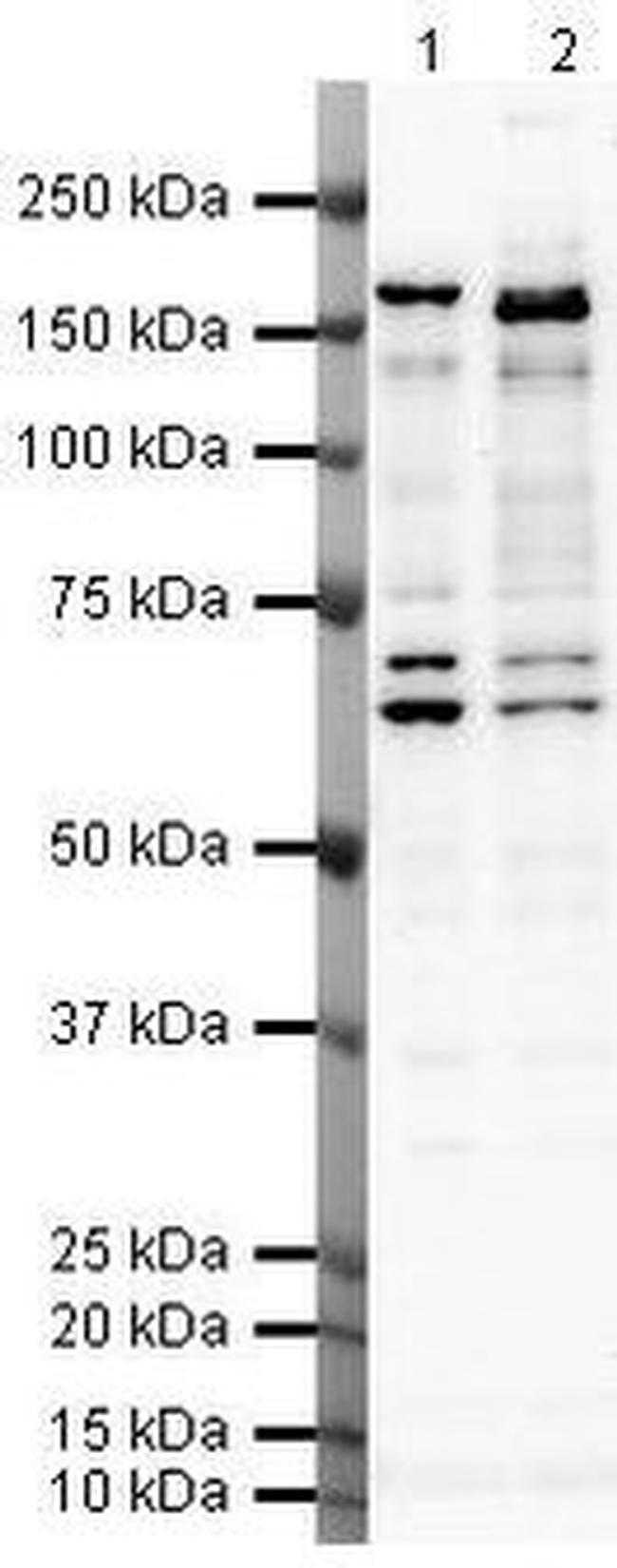 SMARCC2 Antibody in Western Blot (WB)