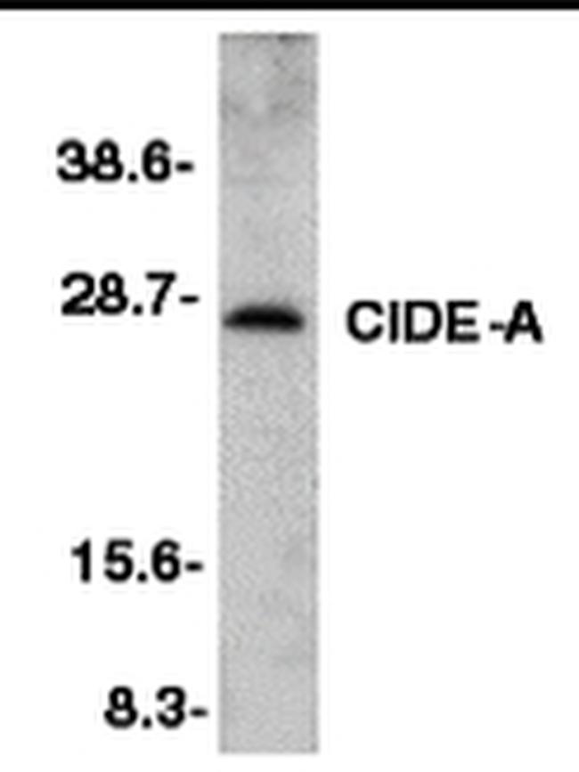 CIDEA Antibody in Western Blot (WB)