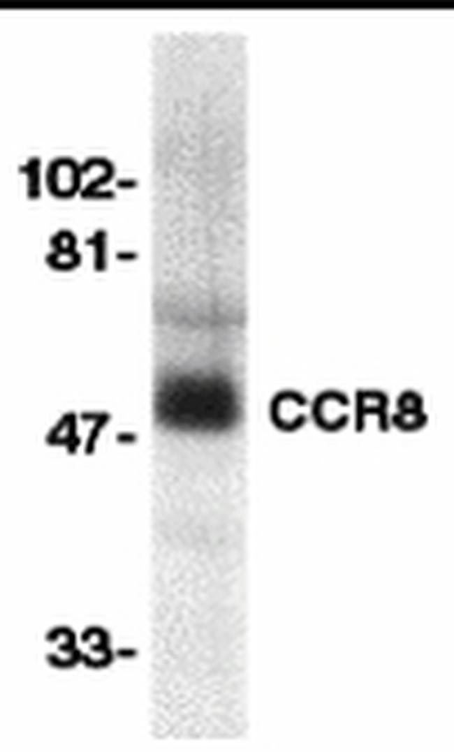 CCR8 Antibody in Western Blot (WB)