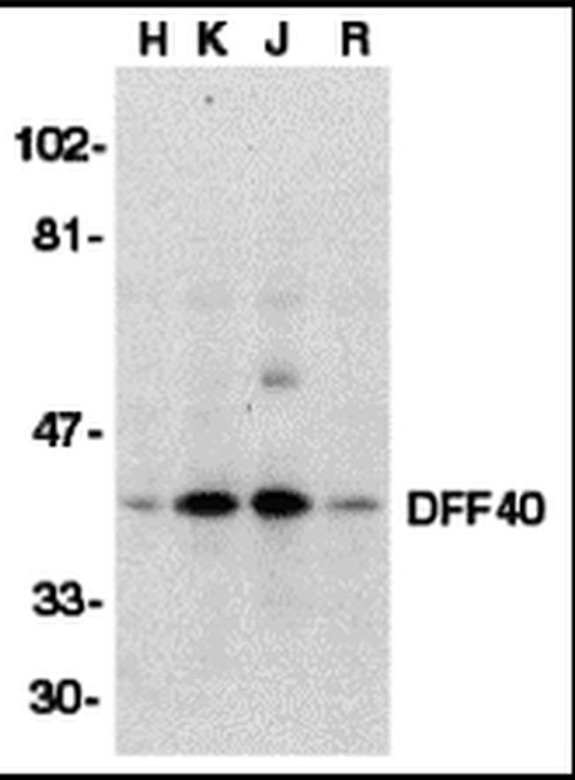 DFFB Antibody in Western Blot (WB)