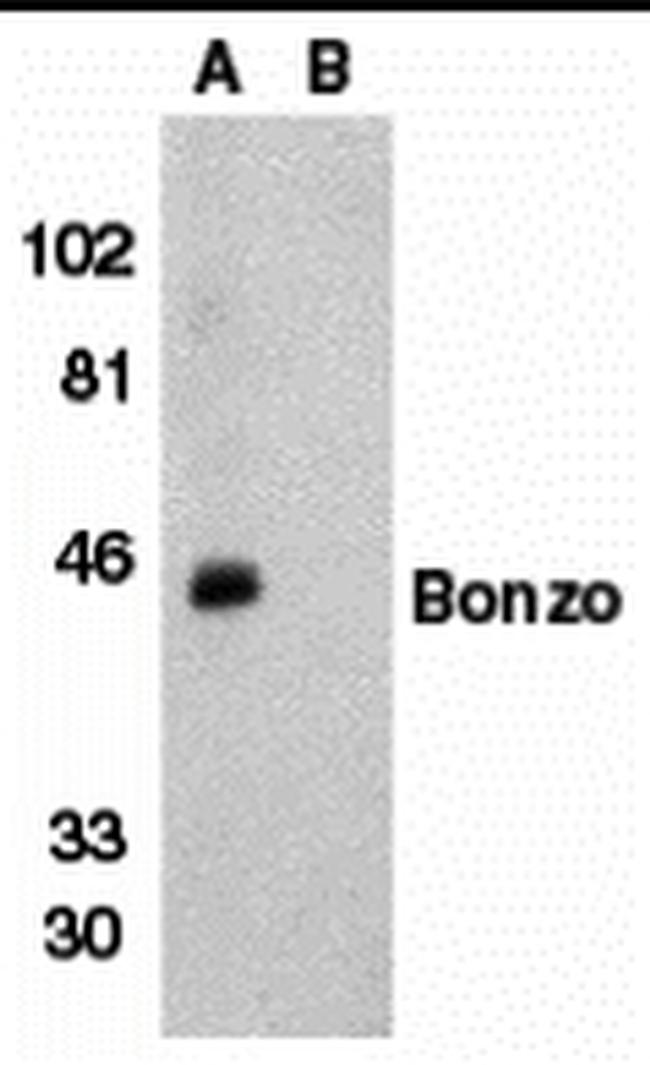 CXCR6 Antibody in Western Blot (WB)
