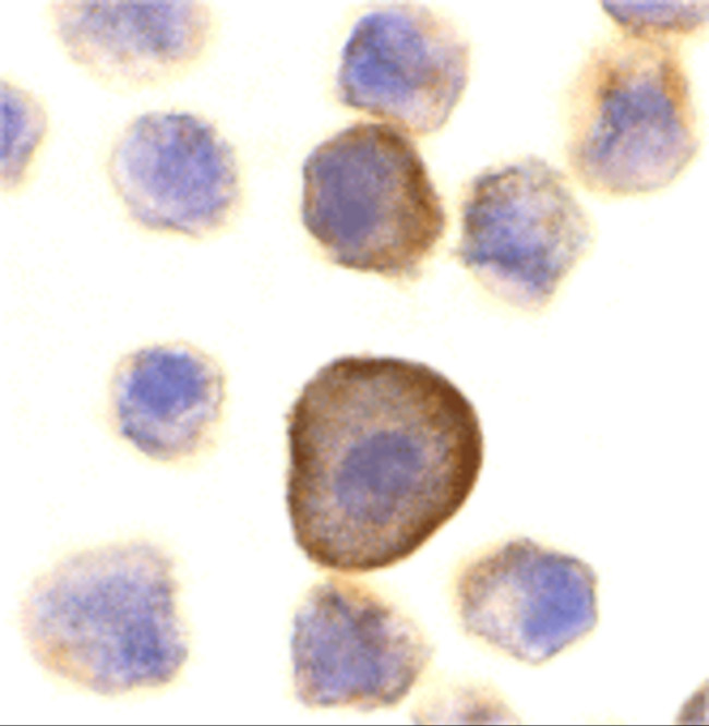 PERP Antibody in Immunocytochemistry (ICC/IF)