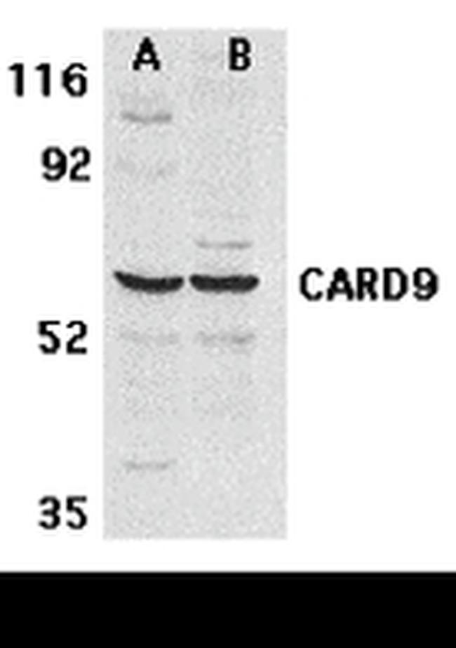 CARD9 Antibody in Western Blot (WB)