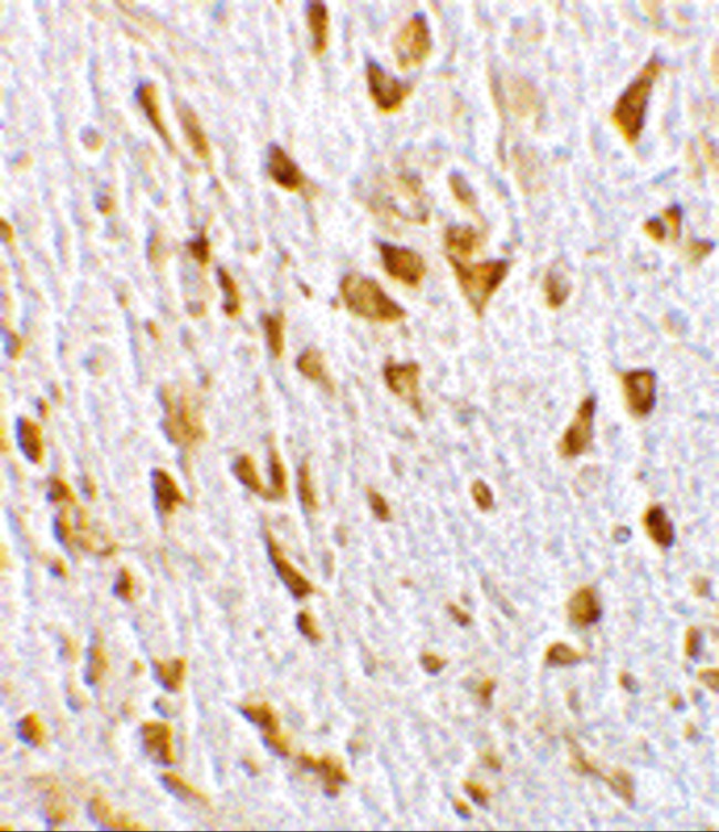 CENTG1 Antibody in Immunohistochemistry (IHC)