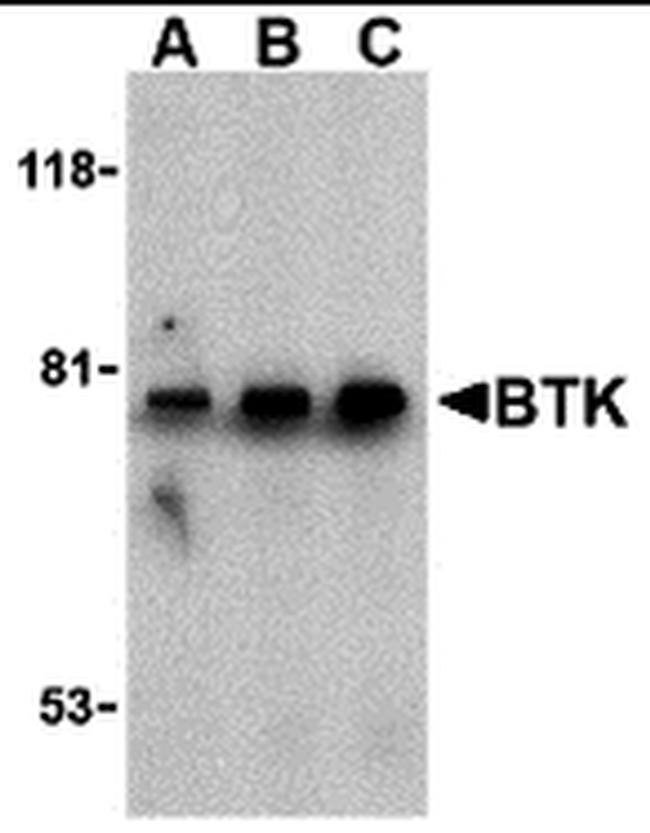 Btk Antibody in Western Blot (WB)