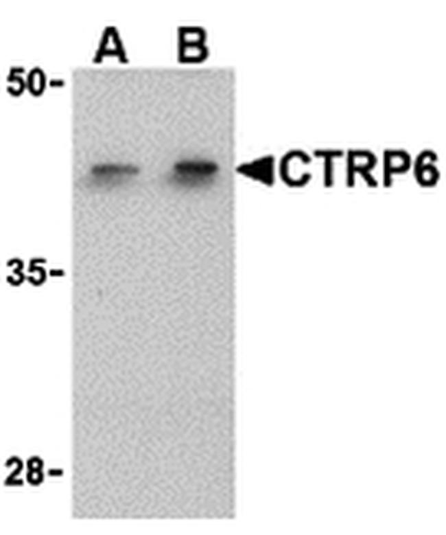 CTRP6 Antibody in Western Blot (WB)