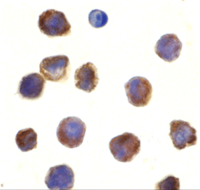 TLR3 Antibody in Immunocytochemistry (ICC/IF)