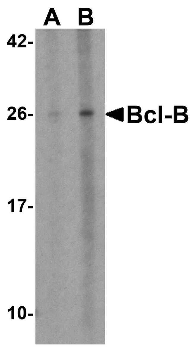 Bcl-B Antibody in Western Blot (WB)