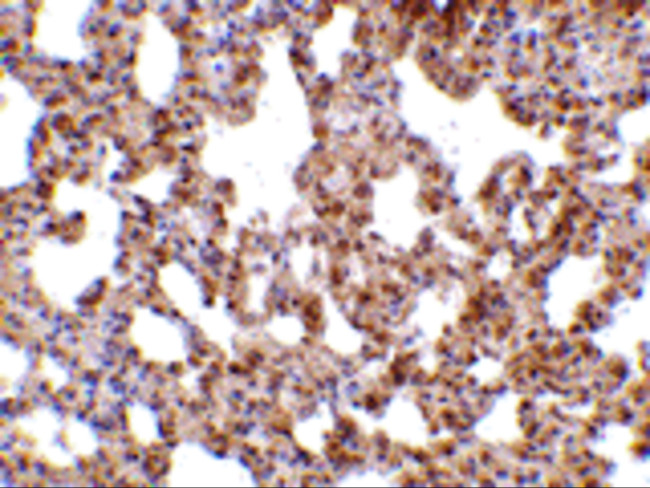TRPC6 Antibody in Immunohistochemistry (IHC)