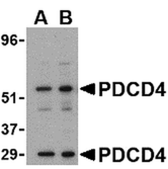 PDCD4 Antibody in Western Blot (WB)