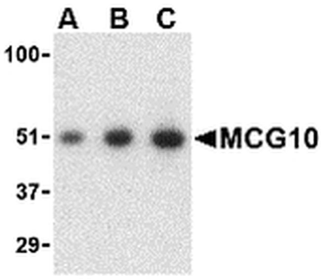 PCBP4 Antibody in Western Blot (WB)