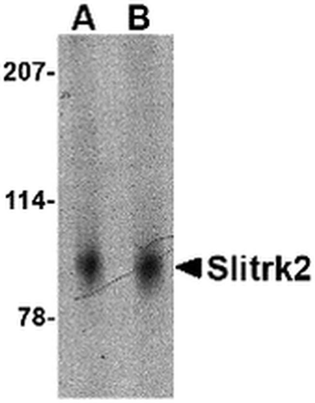 SLITRK2 Antibody in Western Blot (WB)
