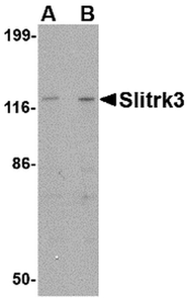SLITRK3 Antibody in Western Blot (WB)