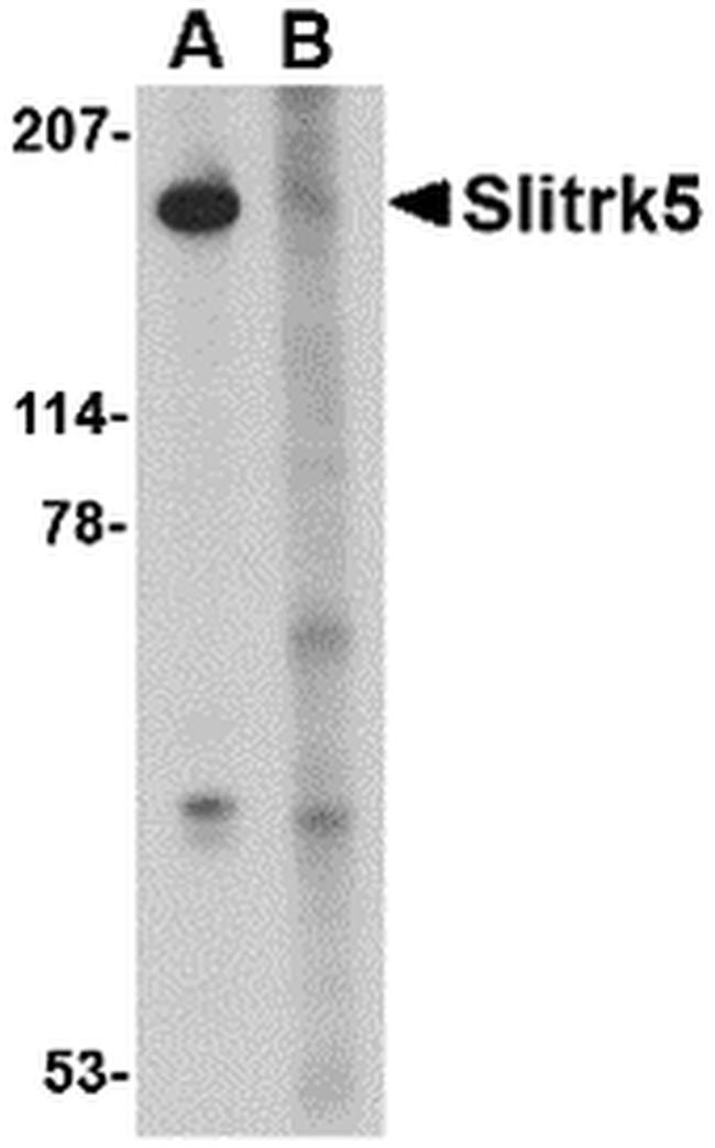 SLITRK5 Antibody in Western Blot (WB)