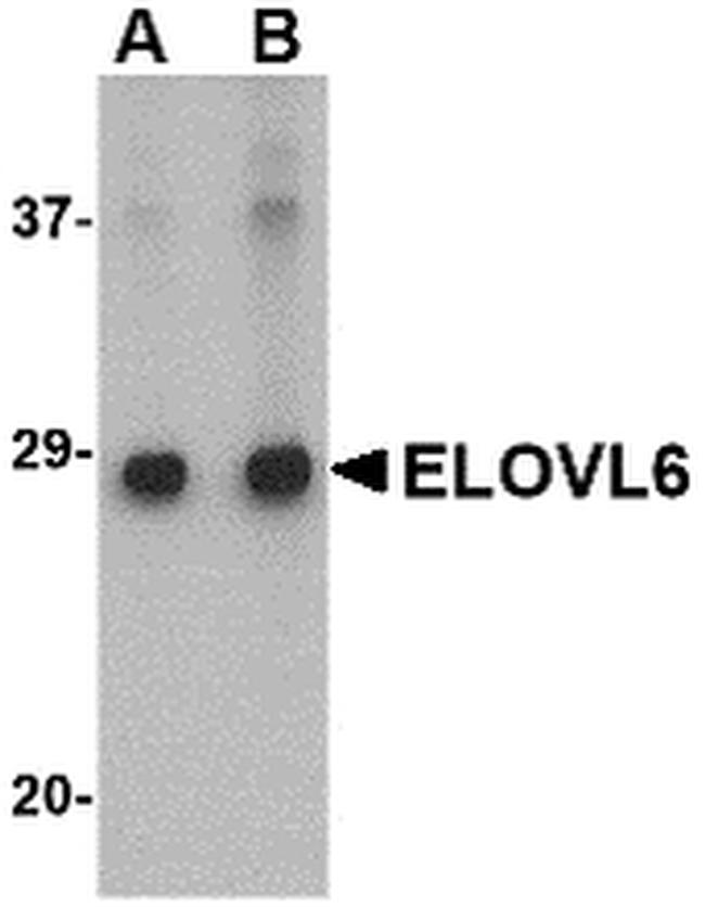 ELOVL6 Antibody in Western Blot (WB)