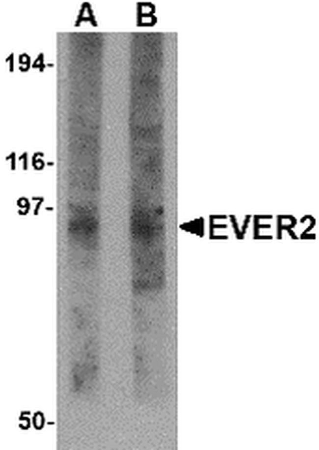 EVER2 Antibody in Western Blot (WB)