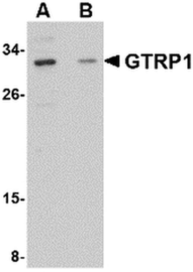 GRTP1 Antibody in Western Blot (WB)