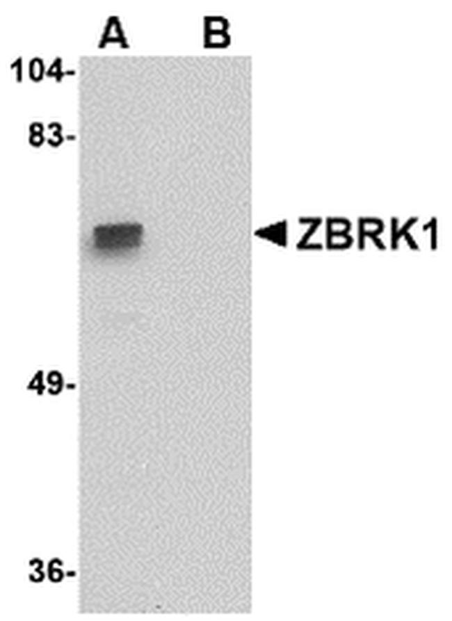 ZNF350 Antibody in Western Blot (WB)