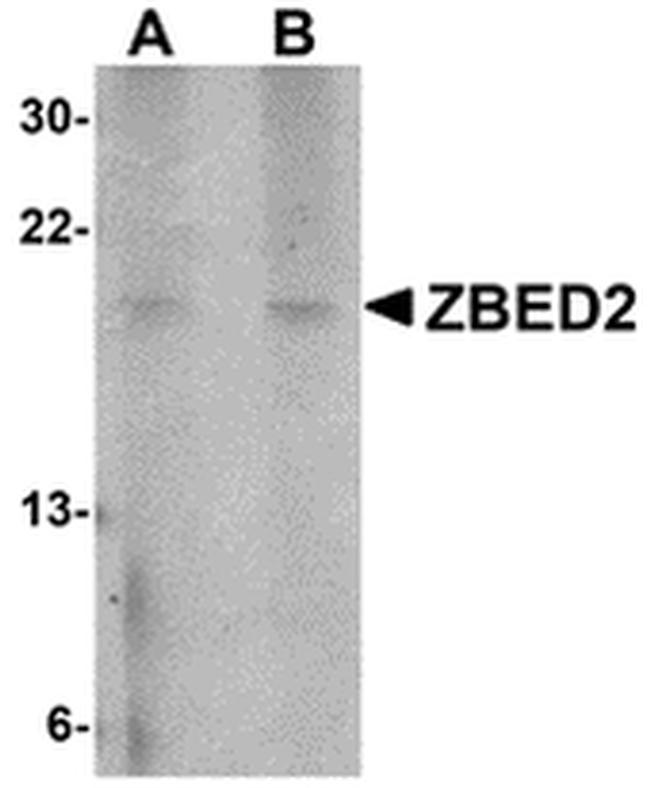 ZBED2 Antibody in Western Blot (WB)