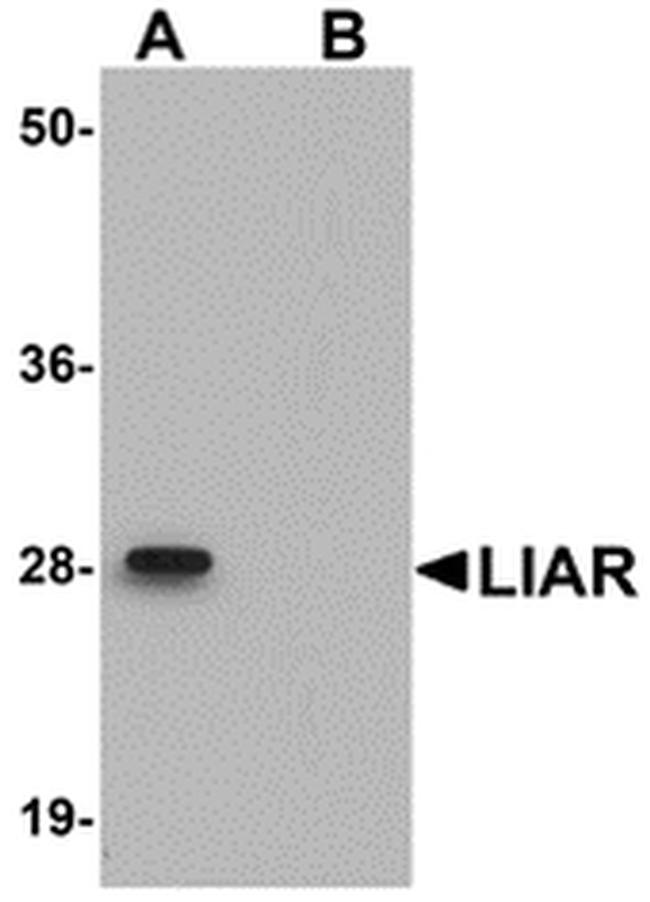 LIAR Antibody in Western Blot (WB)