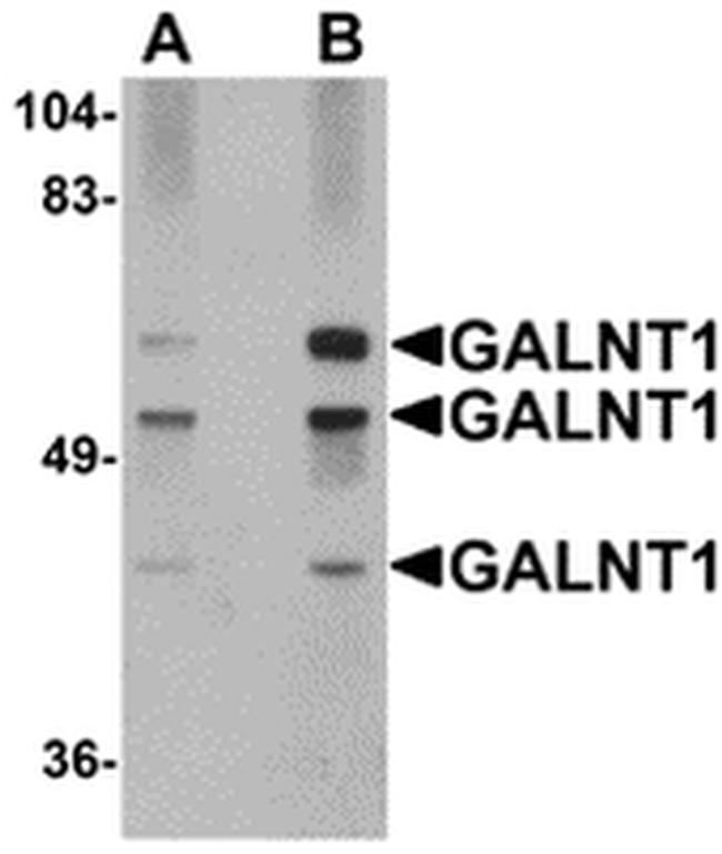 GALNT10 Antibody in Western Blot (WB)