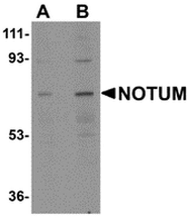 NOTUM Antibody in Western Blot (WB)