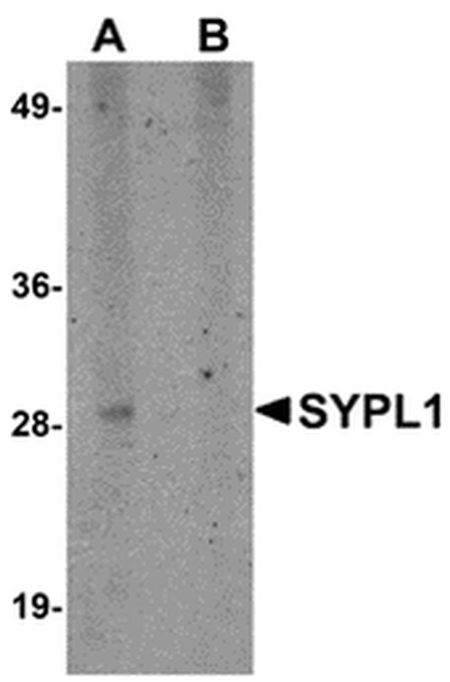SYPL1 Antibody in Western Blot (WB)
