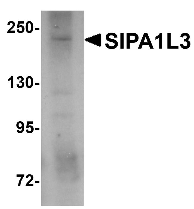 SIPA1L3 Antibody in Western Blot (WB)