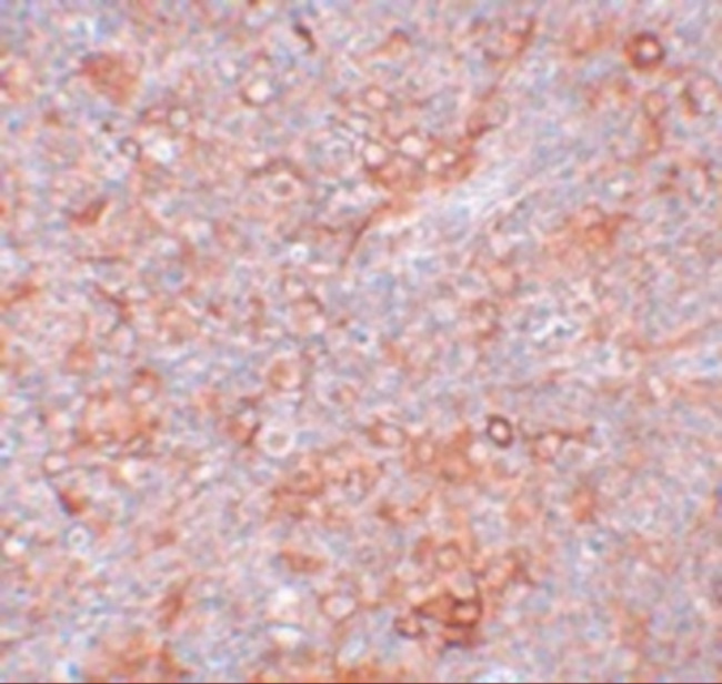 TMEM38B Antibody in Immunohistochemistry (IHC)