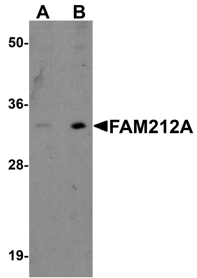 FAM212A Antibody in Western Blot (WB)
