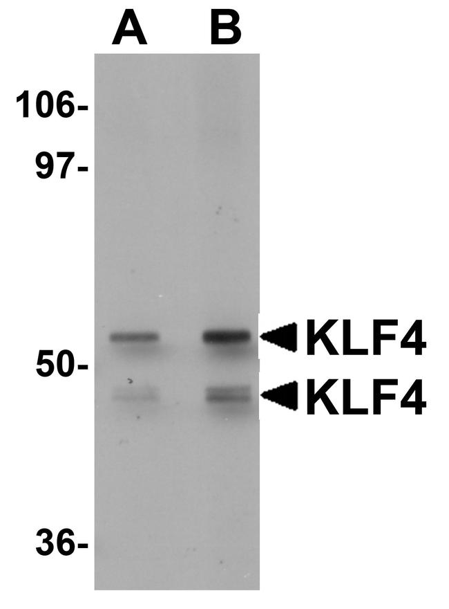 KLF4 Antibody in Western Blot (WB)