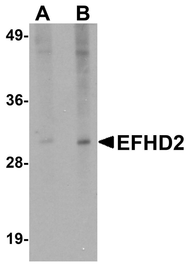 EFHD2 Antibody in Western Blot (WB)