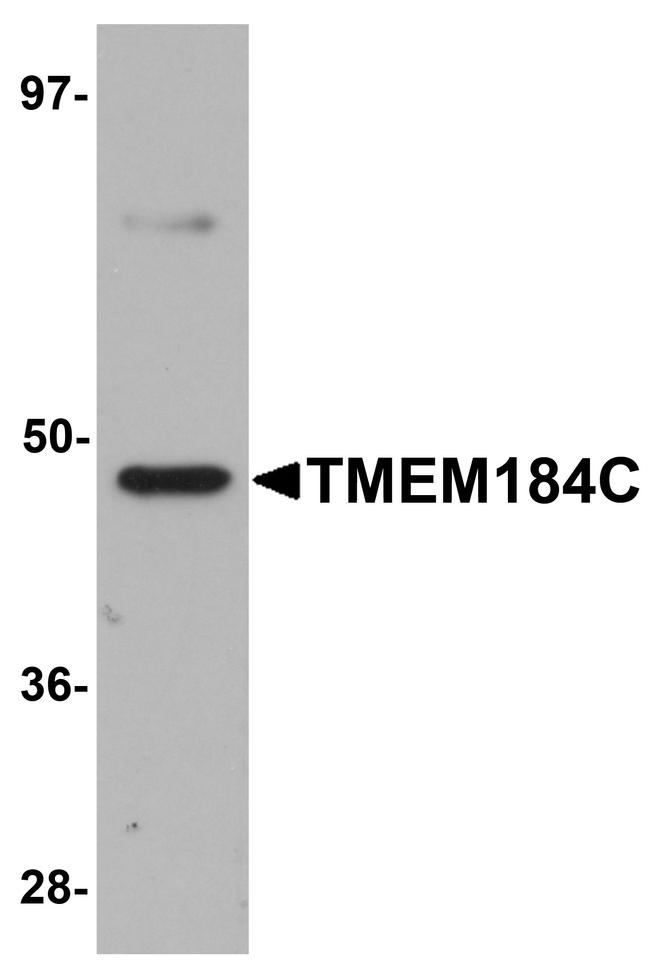 TMEM184C Antibody in Western Blot (WB)