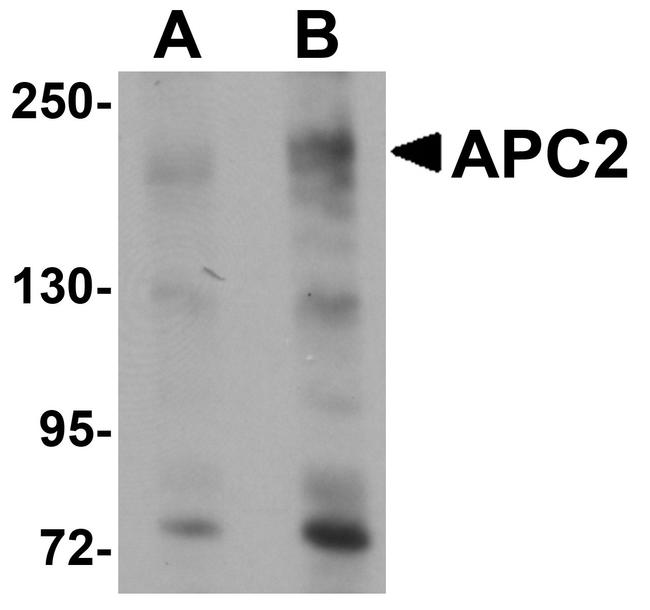 APC2 Antibody in Western Blot (WB)