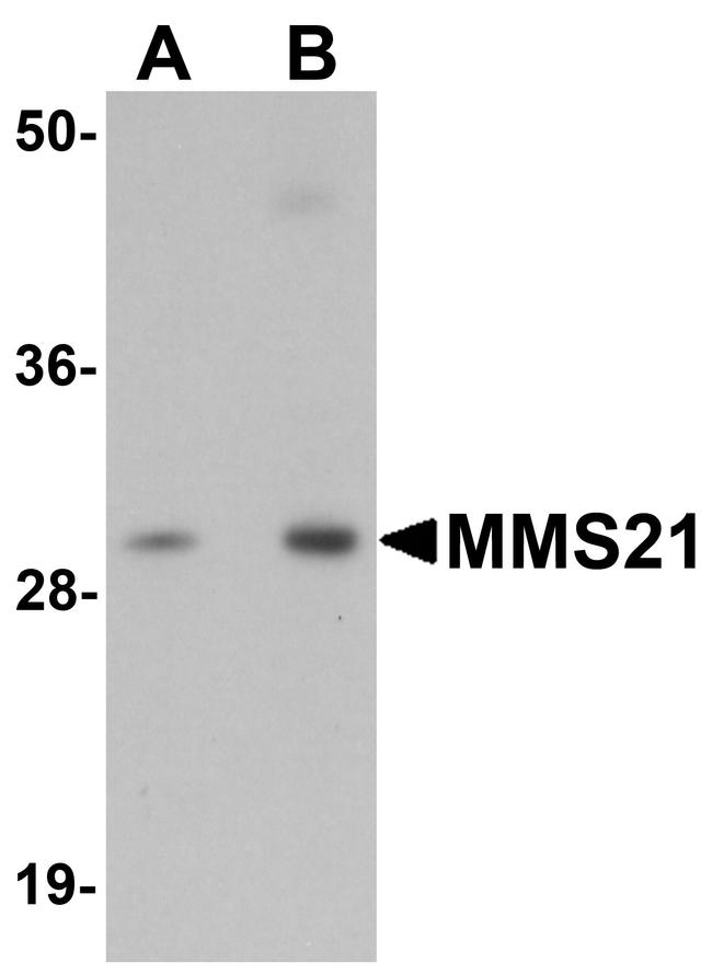 NSE2 Antibody in Western Blot (WB)