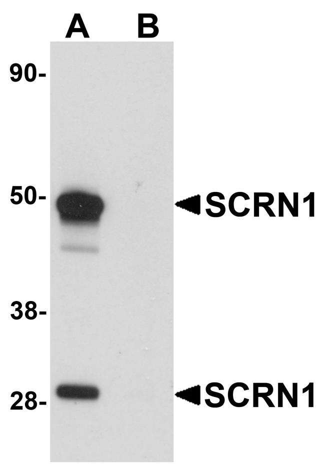 SCRN1 Antibody in Western Blot (WB)
