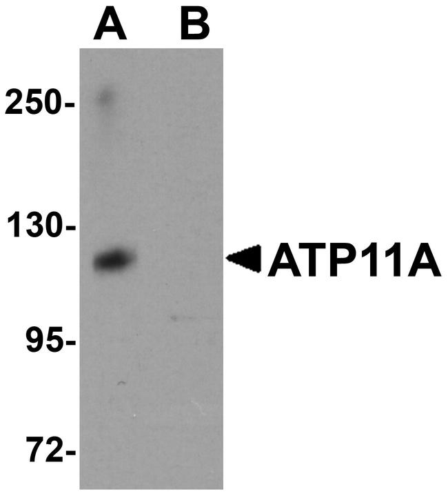 ATP11A Antibody in Western Blot (WB)